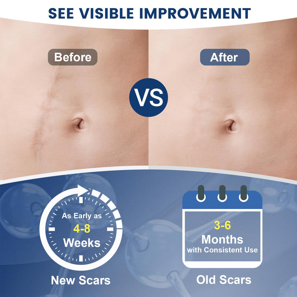 Rvlaim Gel Scar, hydratation profonde, peau plus souple et lisse.