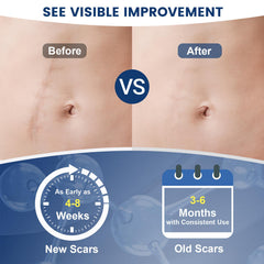 Rvlaim Gel Scar, hydratation profonde, peau plus souple et lisse.