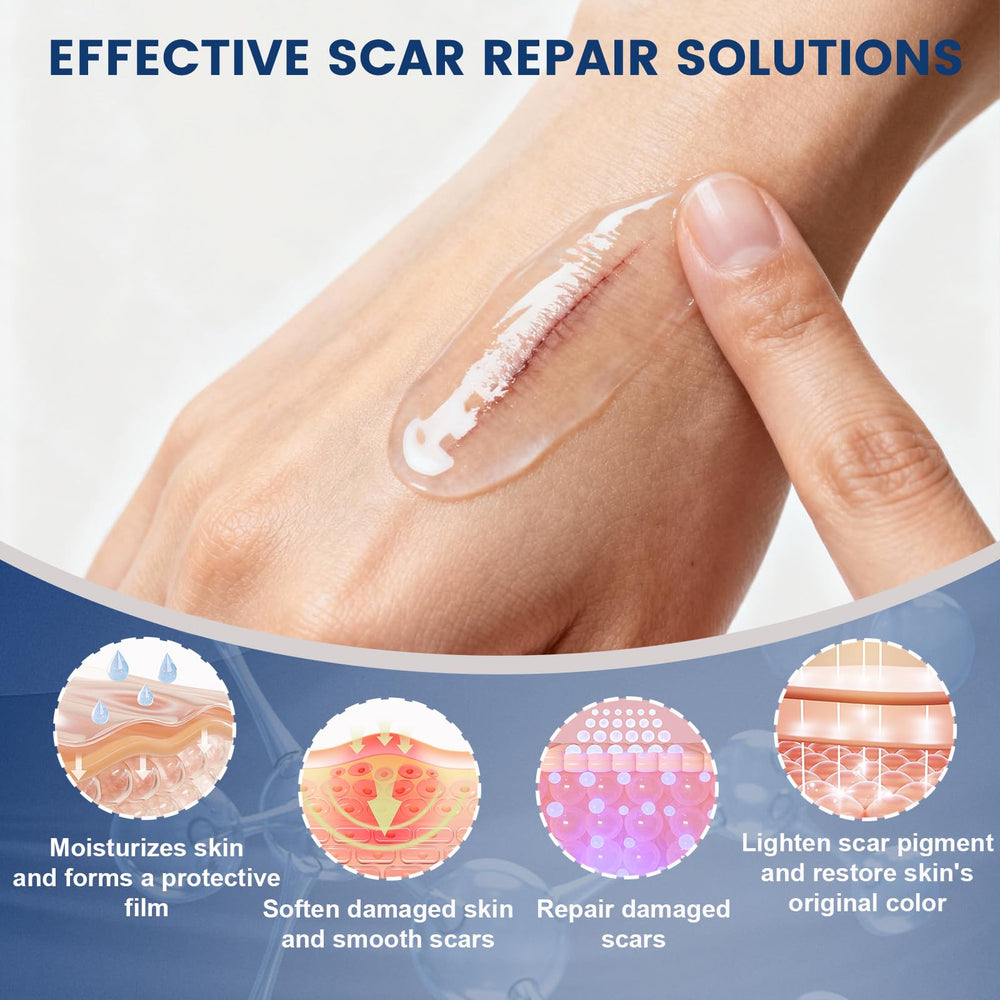 Rvlaim Gel Scar, soin silicone médical, peut aider à lisser les surfaces cicatricielles.