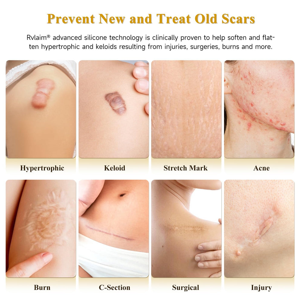 Rvlaim Scar Cream Silicone Gel – Application par la main, texture légère et non grasse.