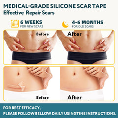RWT bande silicone réutilisable, nettoyage facile et usage prolongé.