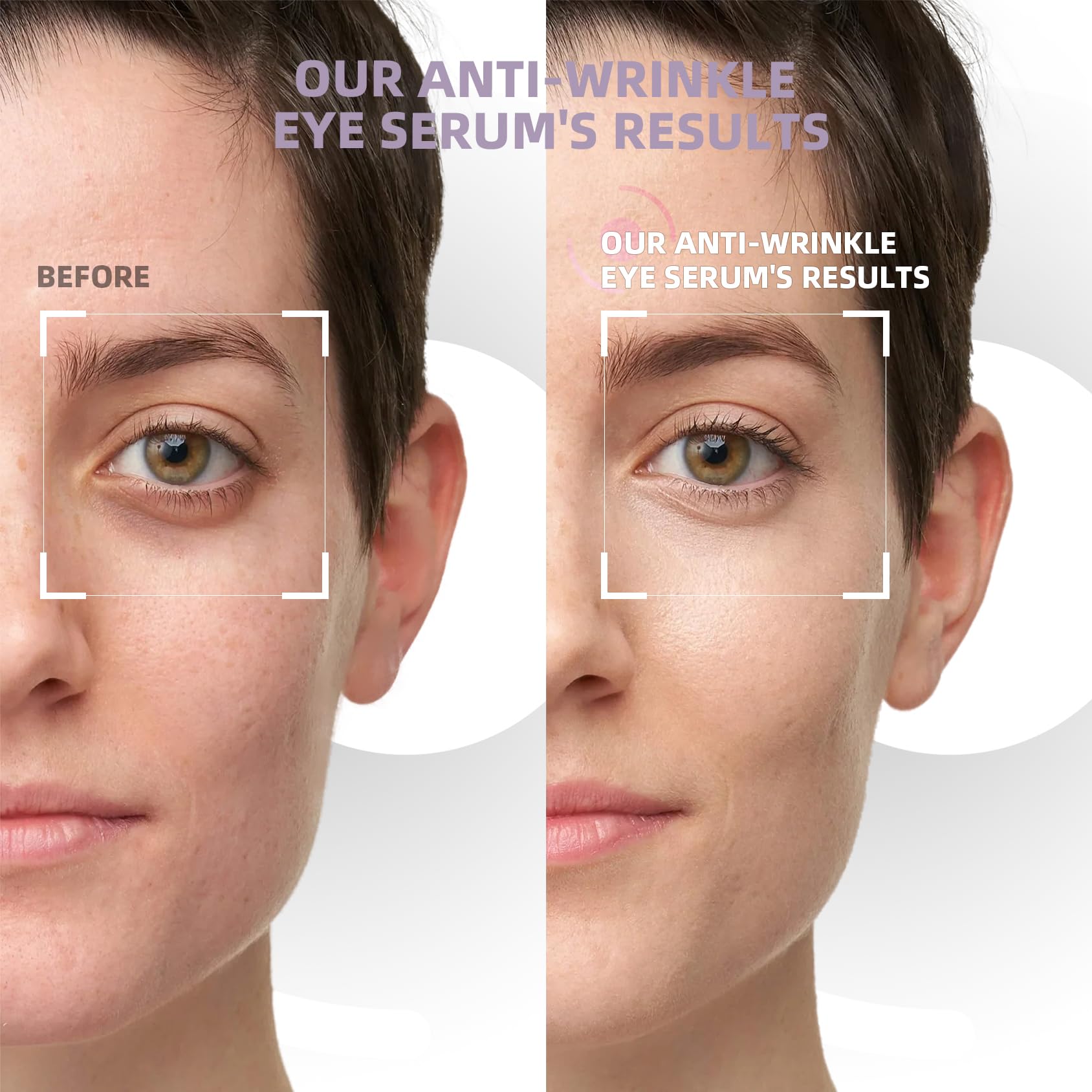 RWT Centella Niacinamide Tea Extract blend nourishes delicate under-eye skin.