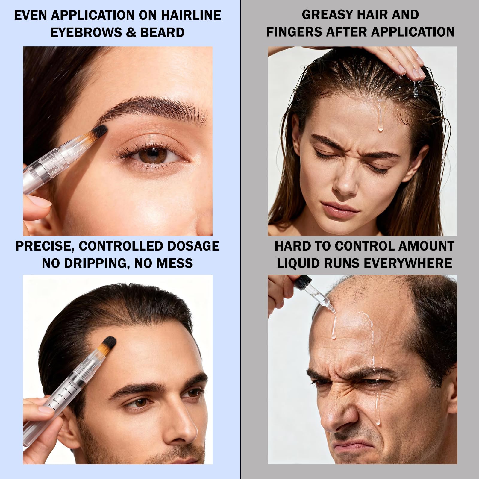 Rylynn Minoxidil Applicator Brush Set: portabilité légère pour routine nomade