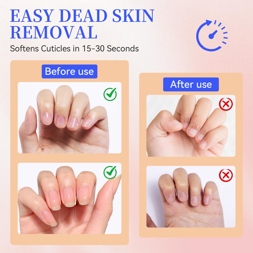 SASSYTIP Gel sur pied permet de soigner les cuticules.