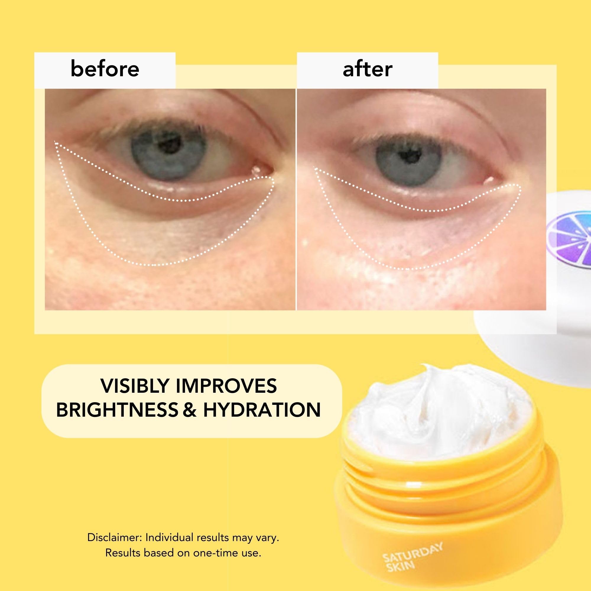 Yuzu et Niacinamide renforcent la barrière et l’hydratation autour des yeux.