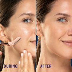 Schick Hydro Silk: microprotecteurs protègent la peau délicate durant dermaplanage.