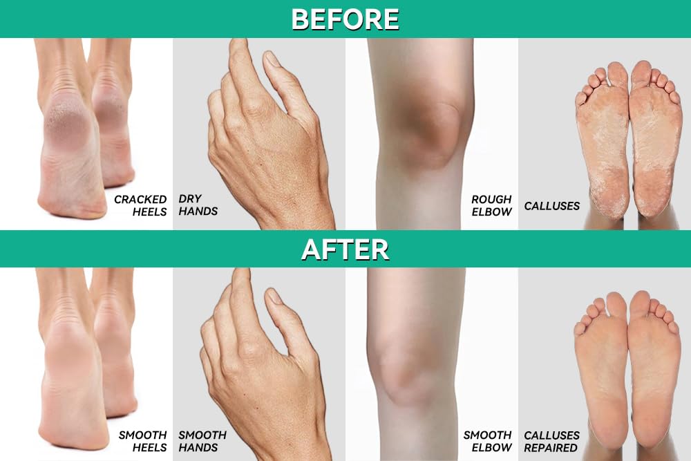 Talons secs — CLEAR 40 peut hydrater et adoucir.