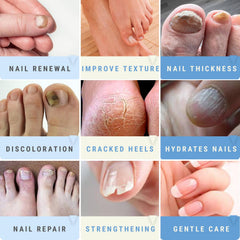 Scientific Solutions Global Urea50 – ongles jaunis traités pour retrouver l’éclat