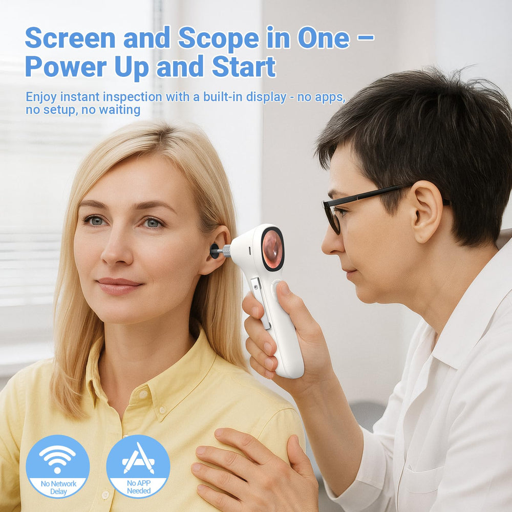 ScopeAround otoscope capture photos et vidéos directement sur la carte incluse.