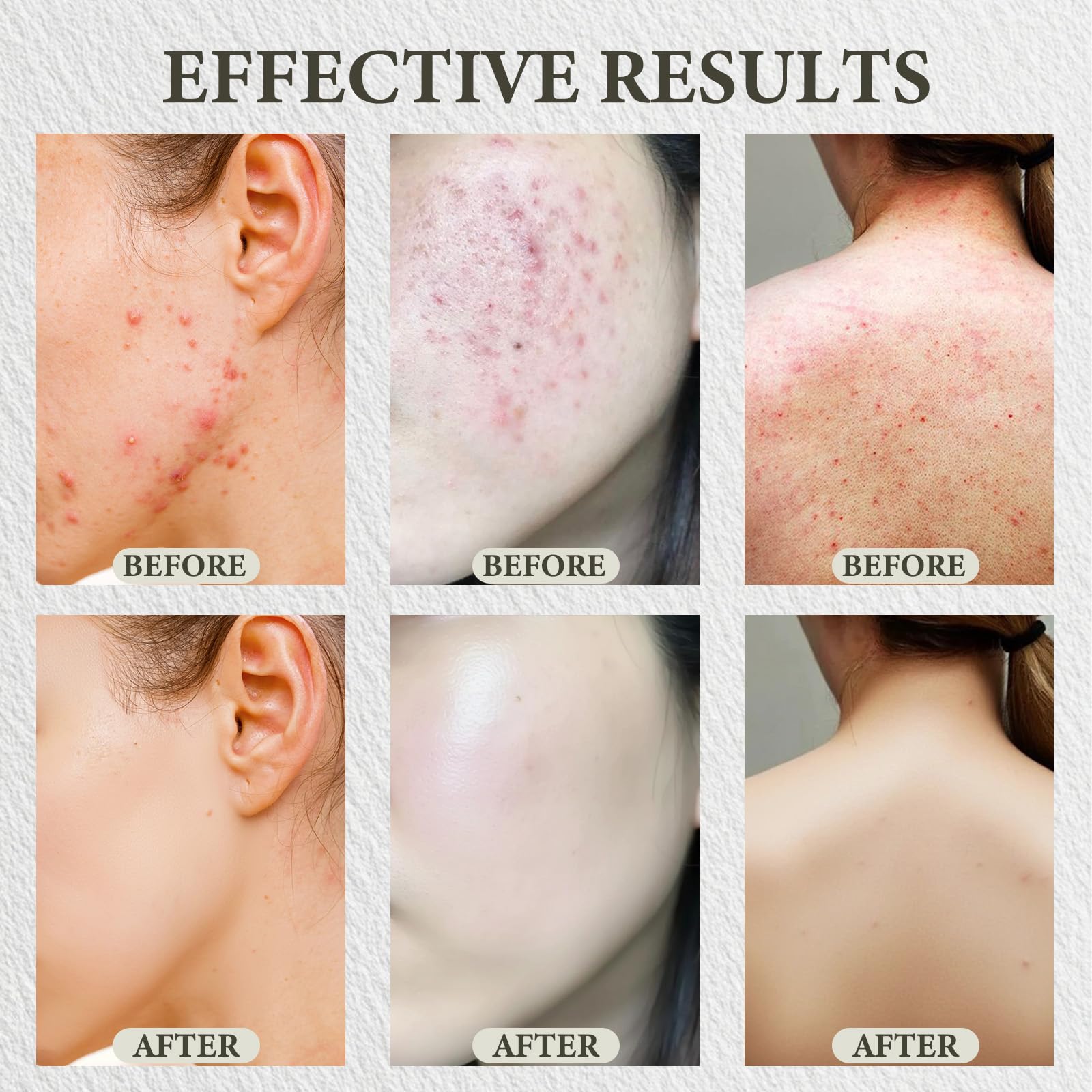 Baume SDXJIOGE barriere-cutanee: hydrate et soutient la barrière naturelle.
