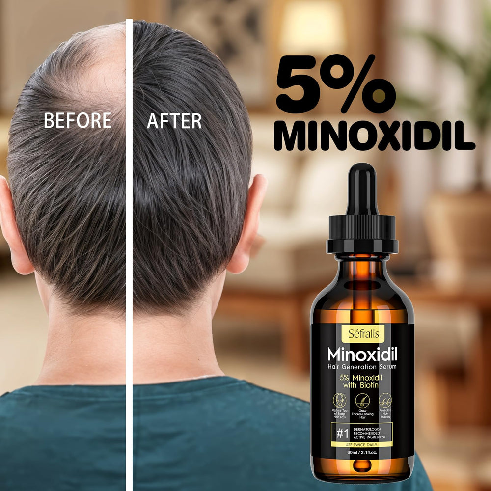 Sefralls Minoxidil 5% – cuir chevelu sain – soutien potentiel à la densité capillaire