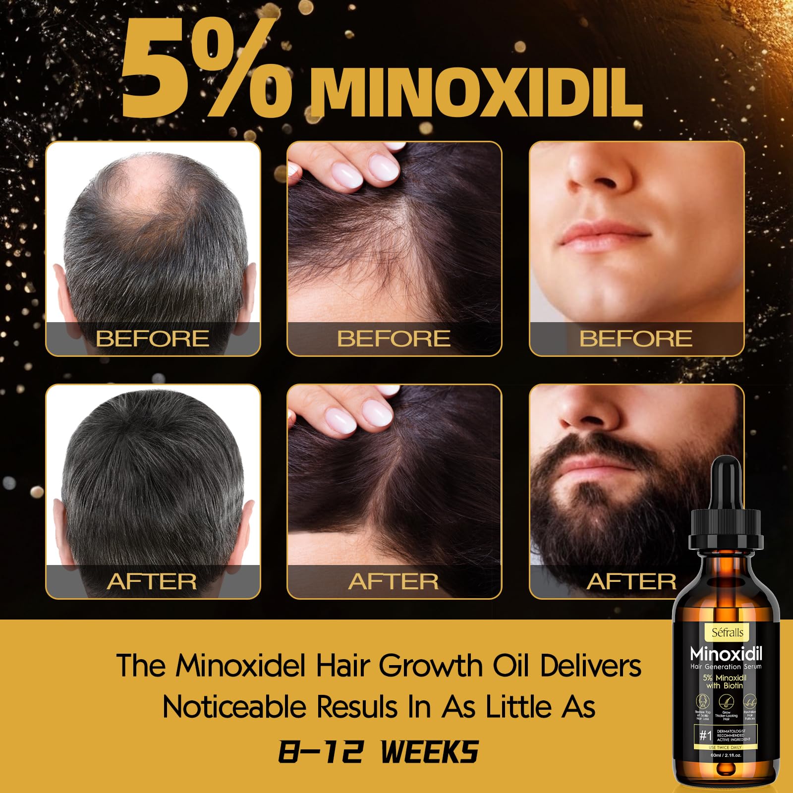 Sefralls Minoxidil 5% – texture onctueuse – application douce sur cuir chevelu