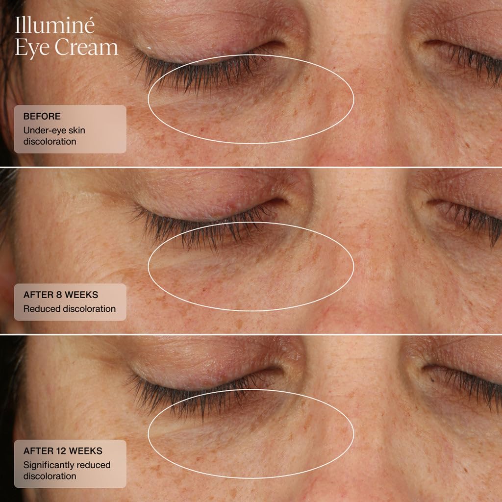 Senté Illumine Crème Yeux—application douce sous les yeux.