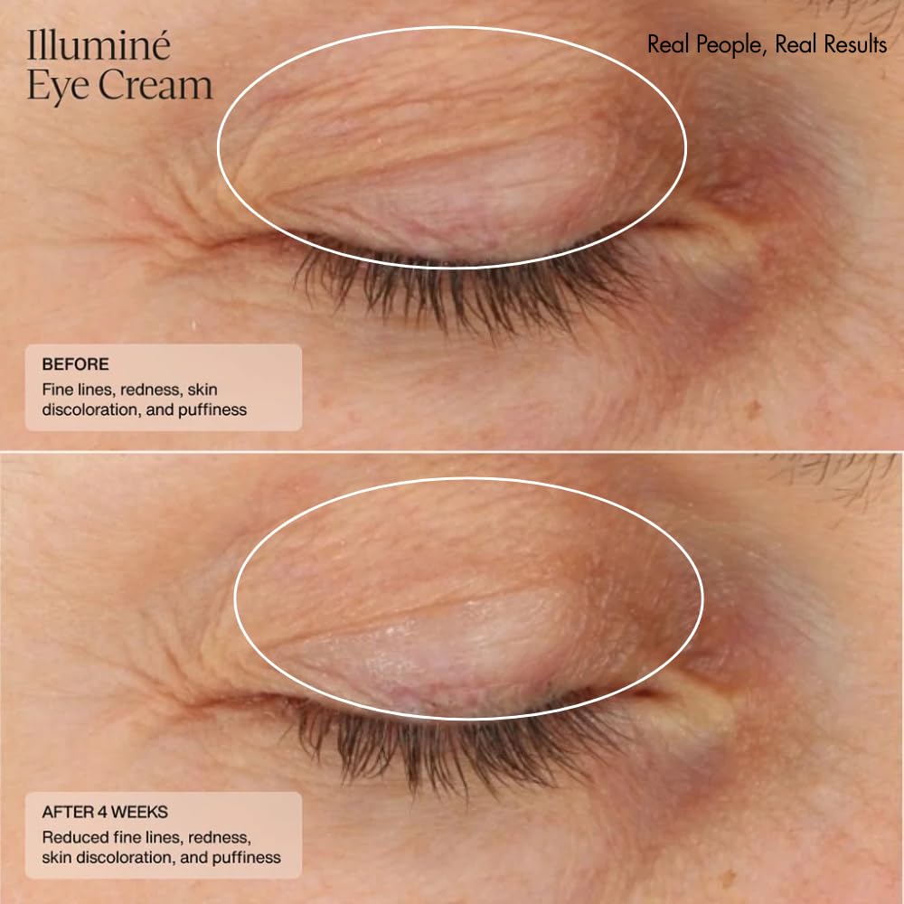 Senté Illumine Crème Yeux—formule sans parfum pour peaux sensibles.