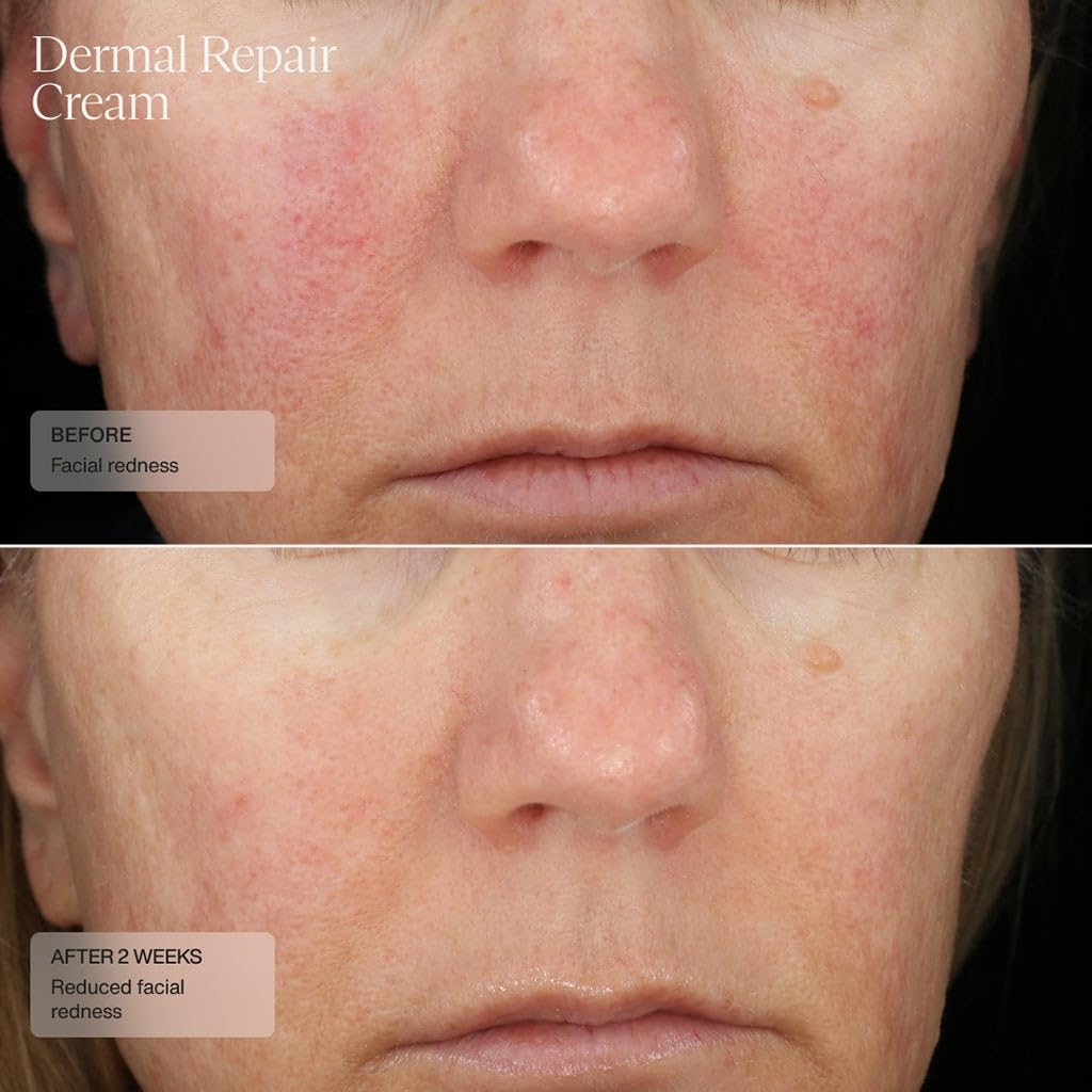 Sente Dermal Repair Crème Application visage et cou avec absorption rapide.