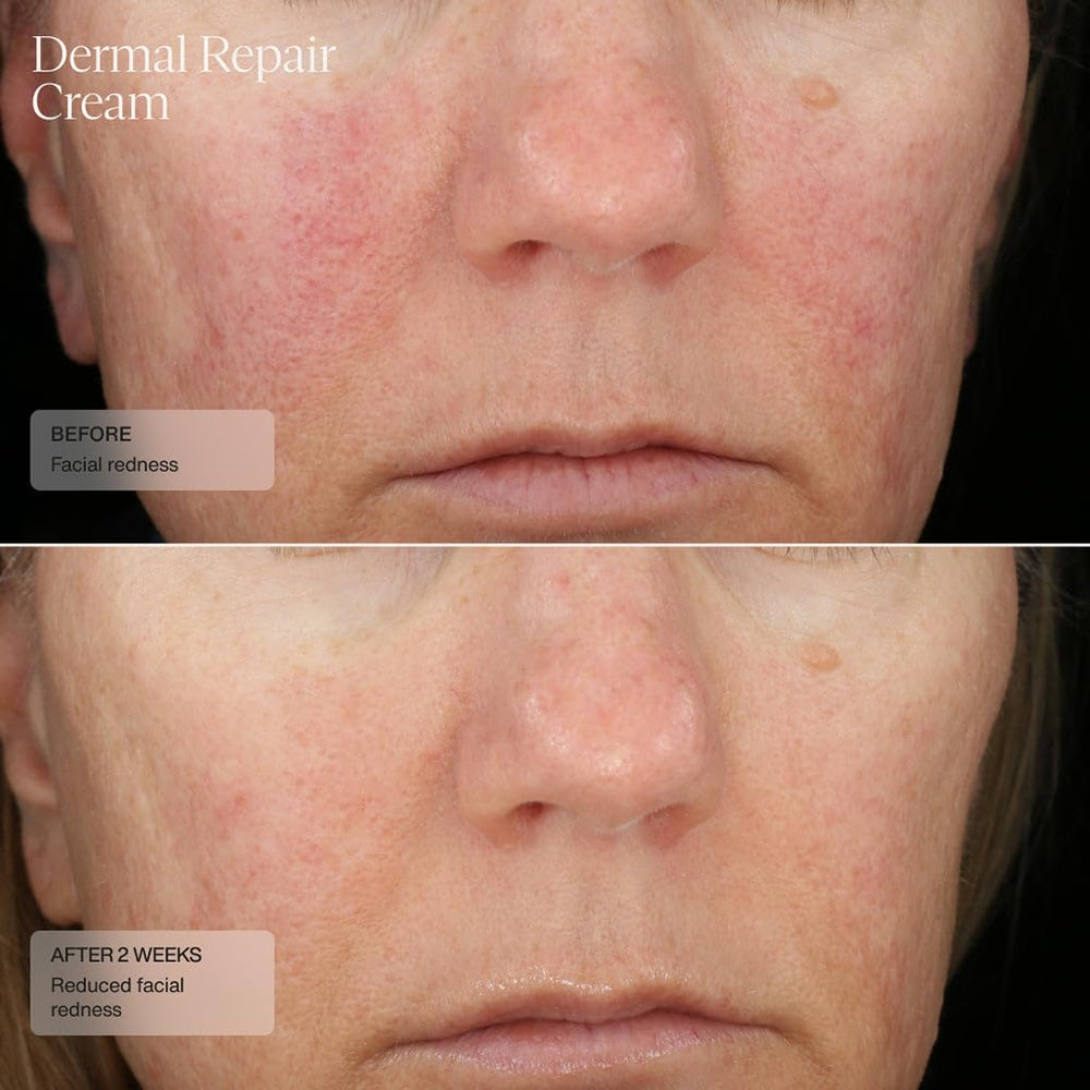 Sente Dermal Repair Crème Application visage et cou avec absorption rapide.