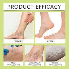 Senzion Miracle Balm hand-application scene emphasizes convenient full-body care.