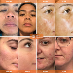 Étiquette claire SeoulCeuticals prête à l’emploi pour routine K‑beauty.