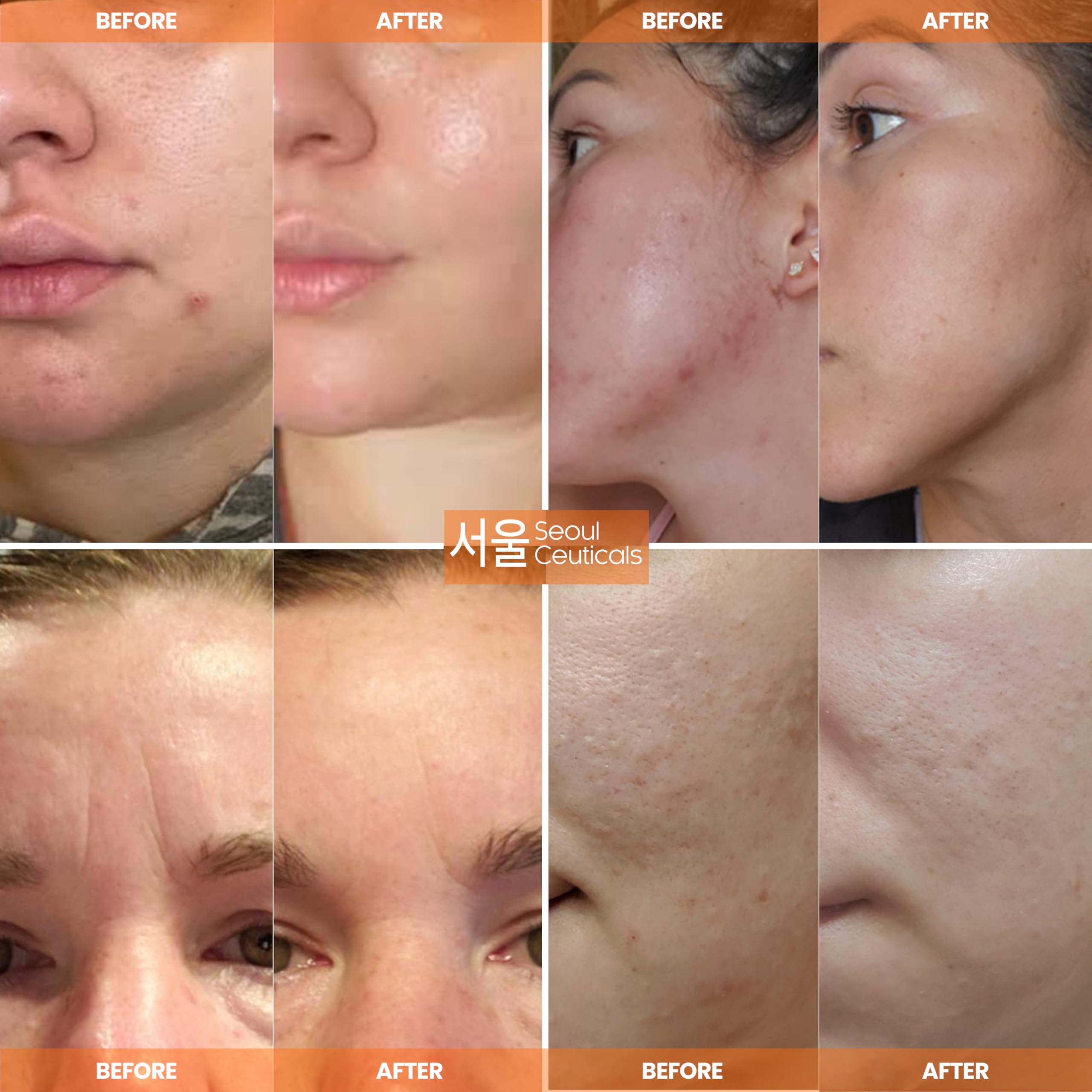 Soin jour et nuit SeoulCeuticals Mucin Escargot – effet nourrissant en douceur.