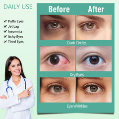 Serfeymi Masque Yeux Vapeur – usage sans fil au bureau ou en voyage.