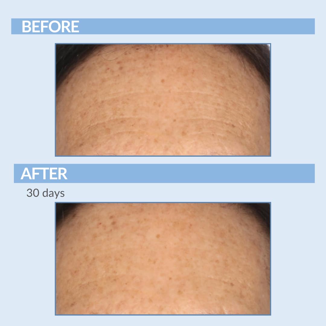Extraits botaniques dans Serious Skincare Rétinol Visage, peau nourrie et apaisée.