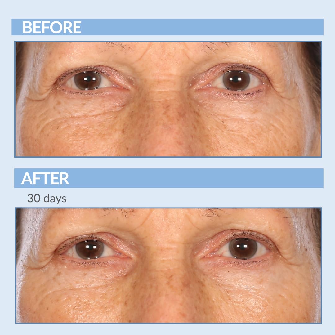Extraits de graines de vigne dans Serious Skincare, soin antioxydant.