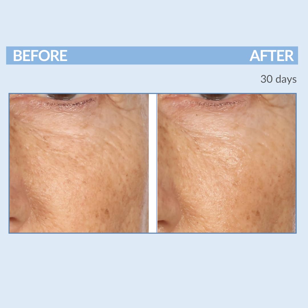 Formulation microencapsulée Serious Skincare Rétinol Visage, libération progressive des actifs.