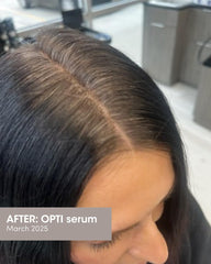 SEVEN Satara Opti, capixyl, soin ciblé pour cheveux fragiles.