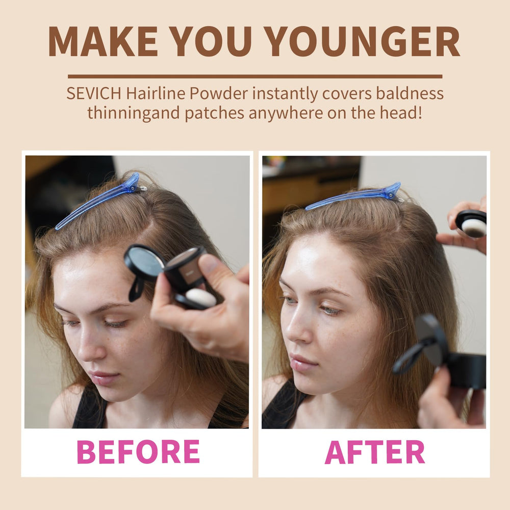 SEVICH Poudre ligne-cheveux brun moyen pour cheveux clairsemés