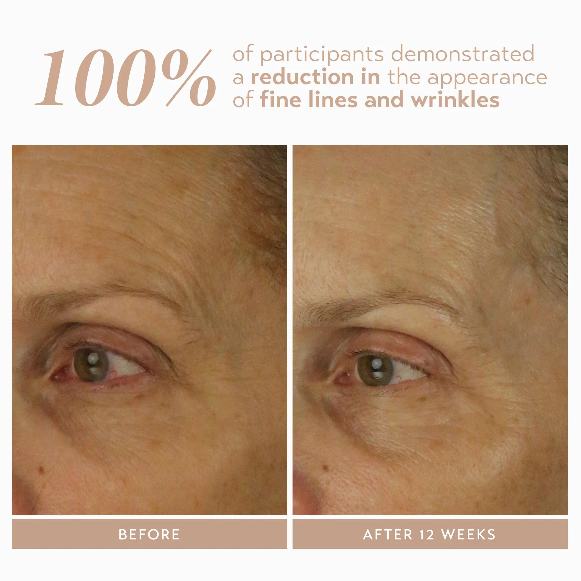 SHANI DARDEN Retinol Reform — application visage et cou avec texture satinée