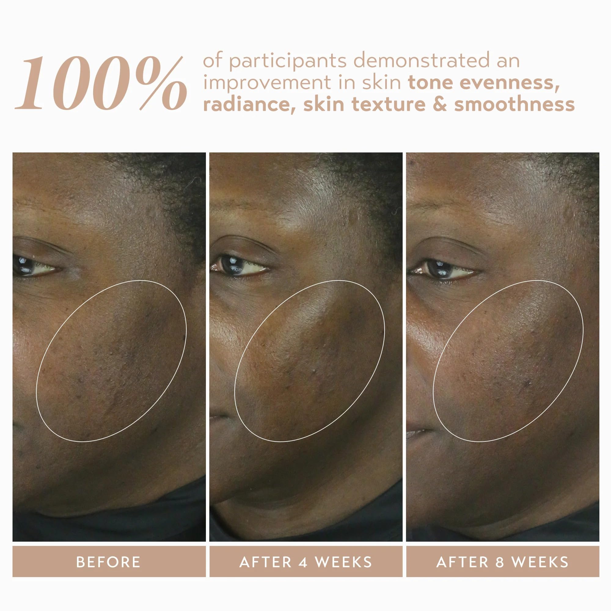 SHANI DARDEN Retinol Reform — extrait de pomme et aloé pour l'hydratation