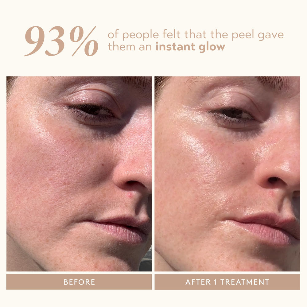 SHANI DARDEN Triple Acid Peel – ingrédients acides favorisant l’exfoliation en douceur.