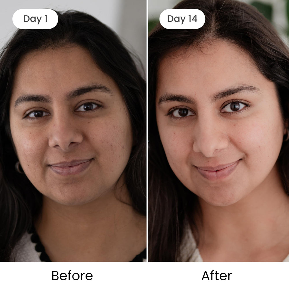 Shankara Kumkumadi Oil for gua sha use promotes soothing facial massage