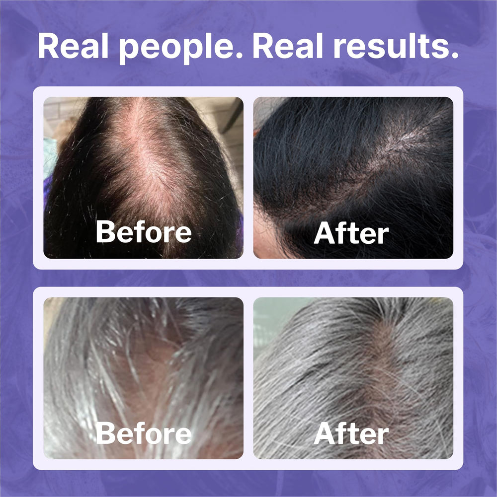 Shapiro MD Hair Growth Experts brand logo displayed