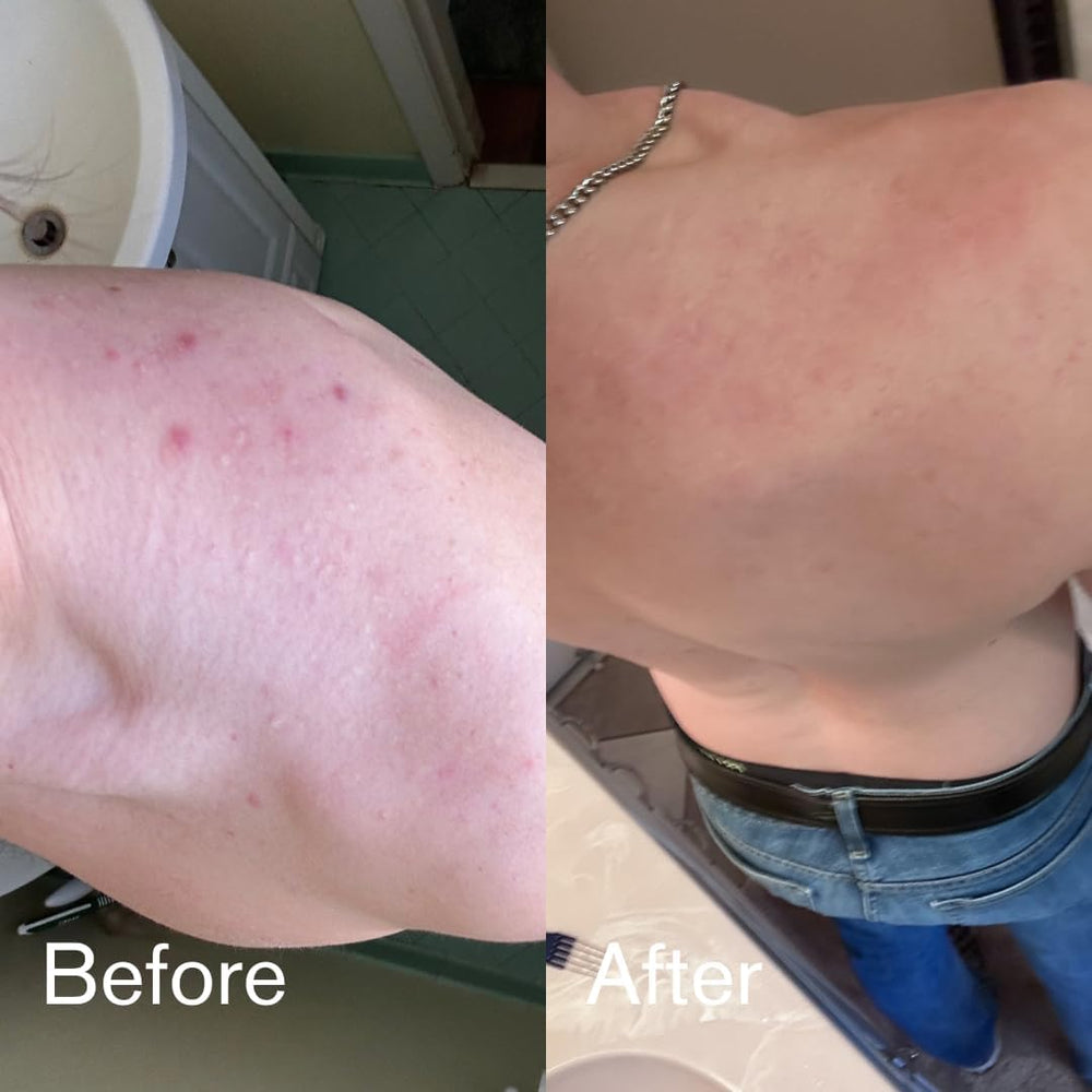 Shield douche quotidienne clarifiante, peau propre après l'entraînement.