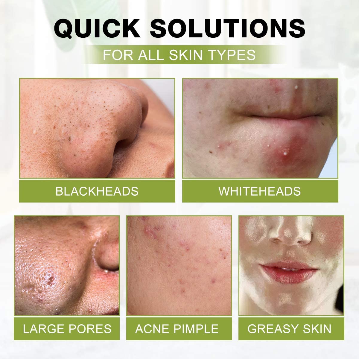 Nettoyage en profondeur SHVYOG pour pores mieux resserrés et peau plus nette.