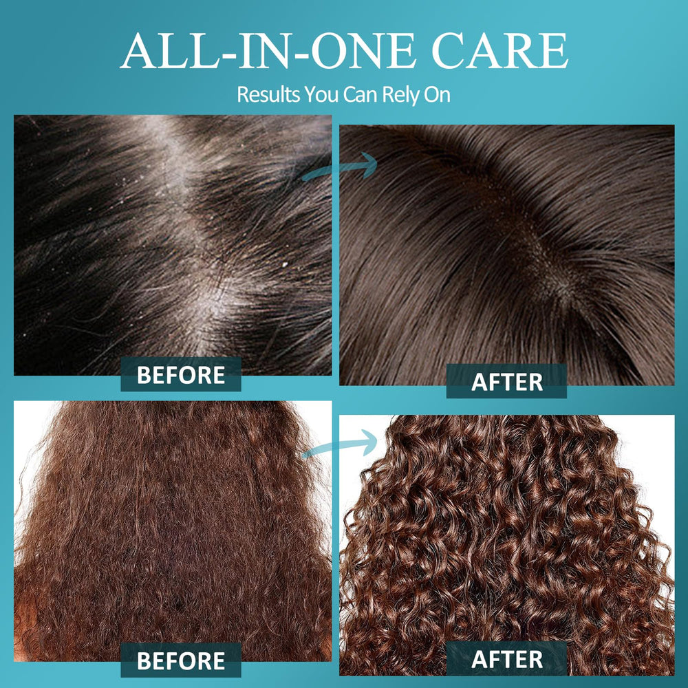 SHVYOG Scrub Cuir Cheveux Massage Capillaire: stimule le cuir chevelu lors de l’application.