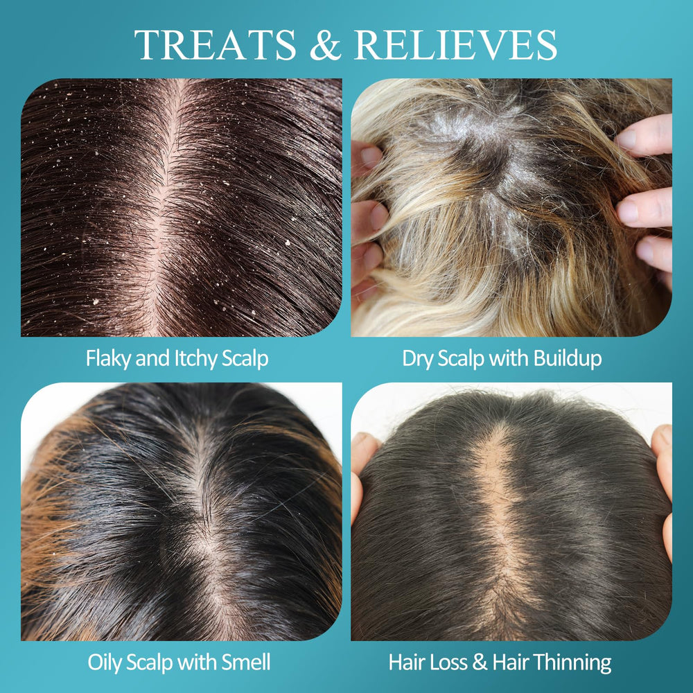 SHVYOG Scrub Cuir Cheveux Salicylique: exfolie en douceur et régule le sébum.