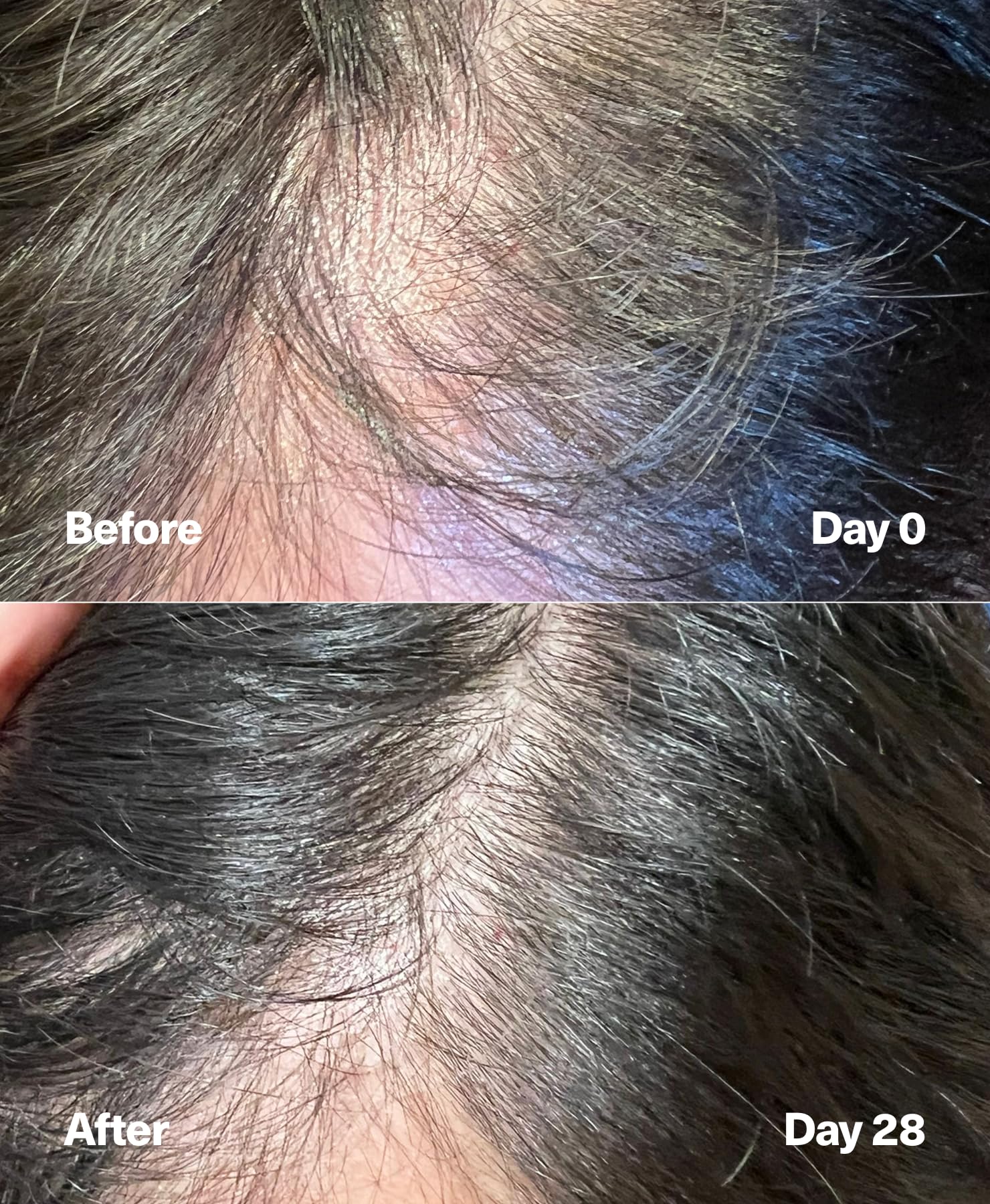 Avant/après : cheveux visiblement plus épais avec PowerCycle Exosome.