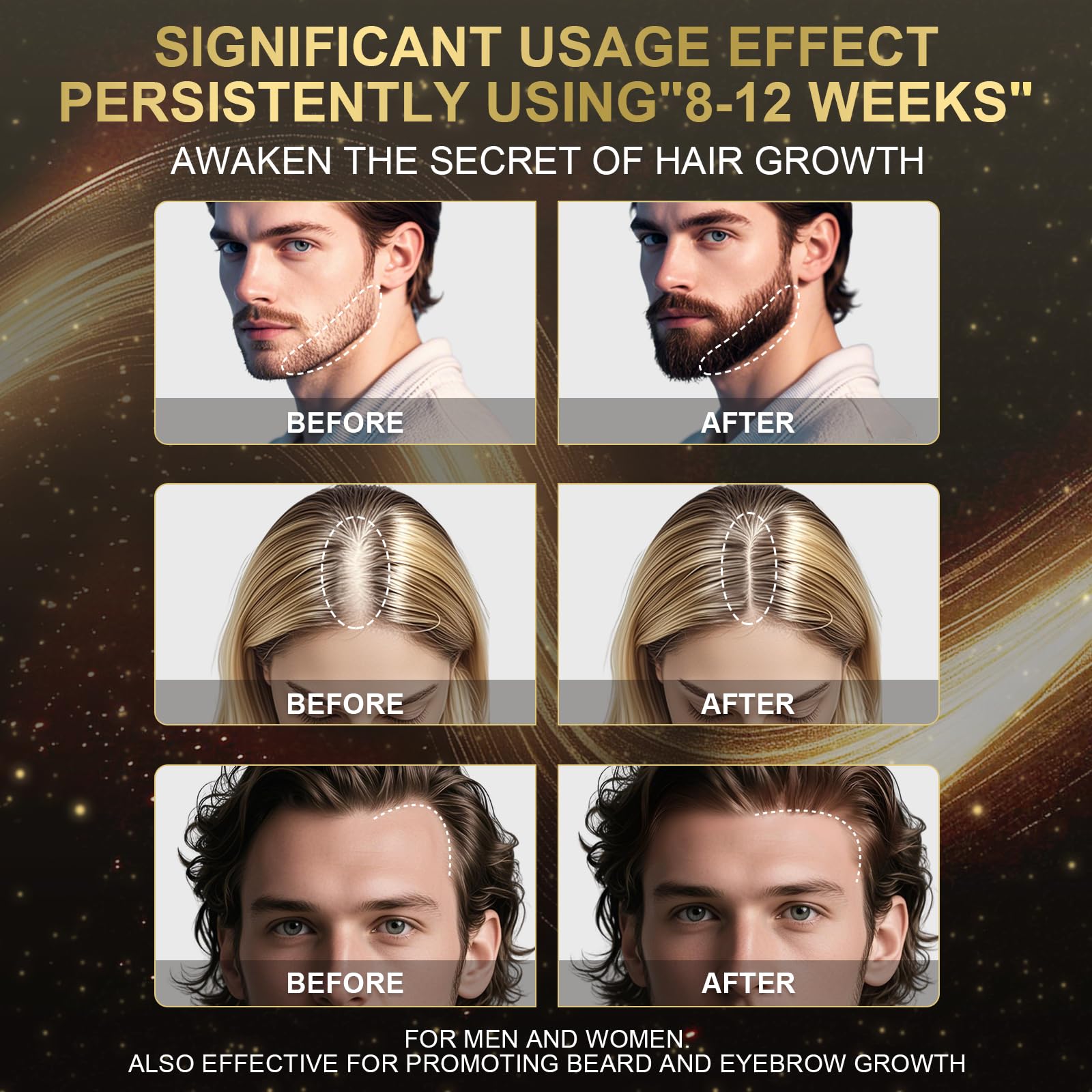 Sidinox Biotine stimule les follicules pour cheveux plus épais