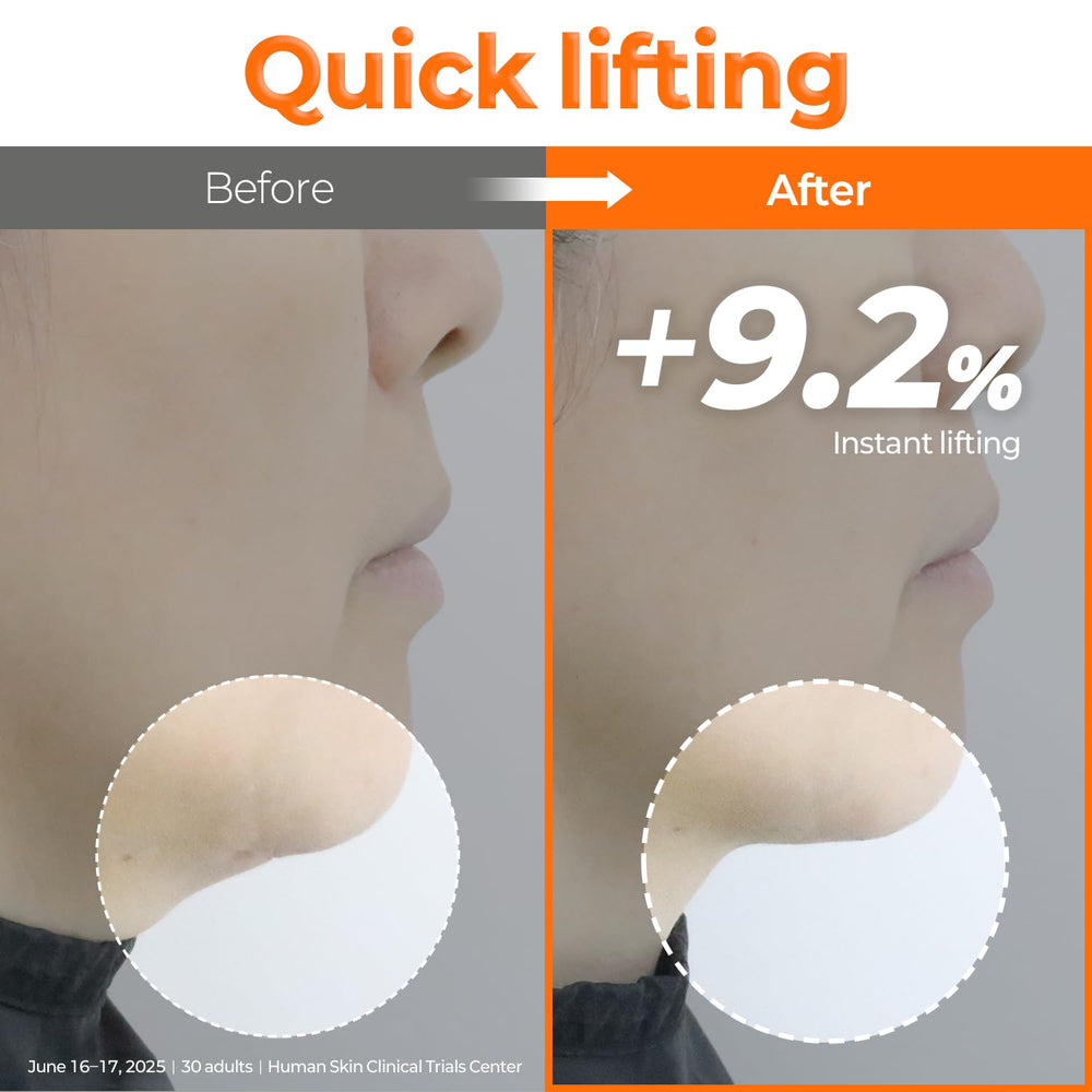 Effet lifting instantané autour des zones clés du visage avec Signiq.