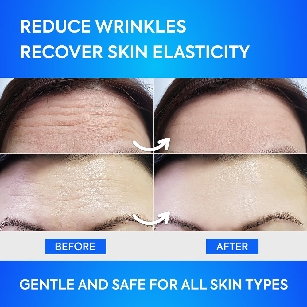 SILKDERMIS patch frontal Hydratation: soin hydratant durable.