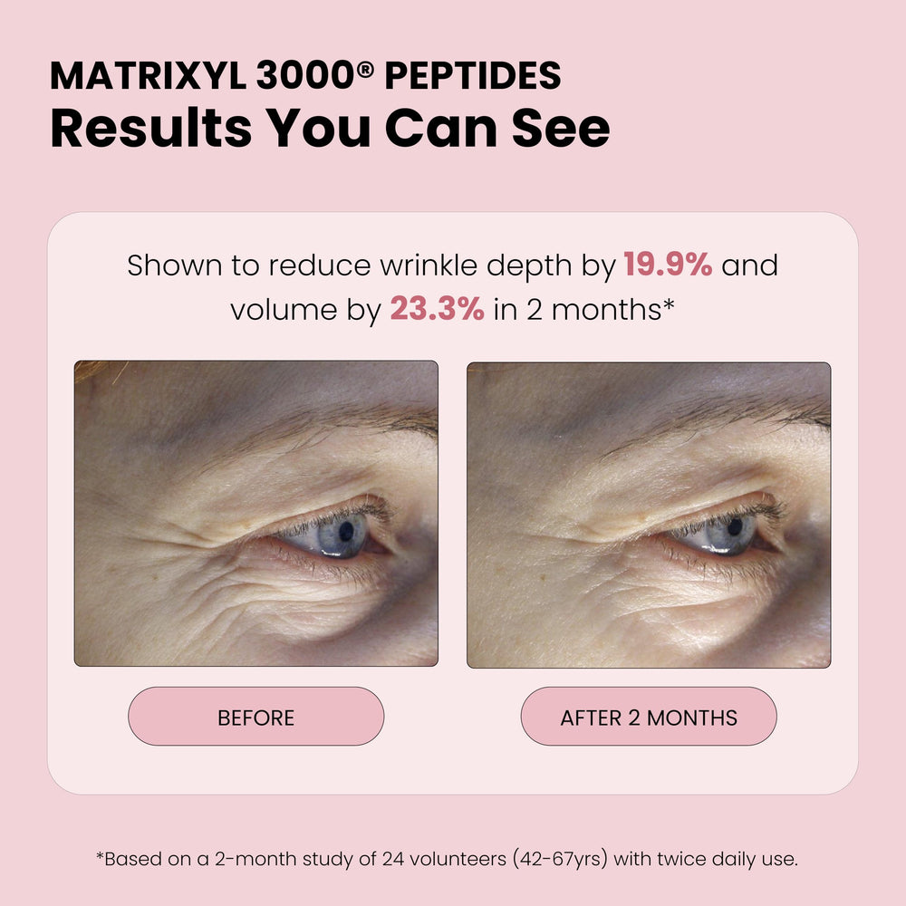 Brume rose hyaluronique: revitalise la peau et rafraîchit durablement.