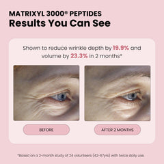 Brume rose hyaluronique: revitalise la peau et rafraîchit durablement.
