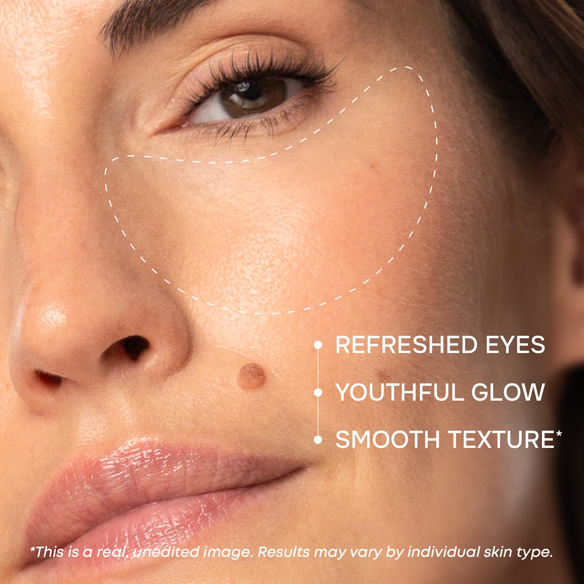Patch SimplyVital yeux anti-poches éclaircit légèrement les cernes et unifie le teint