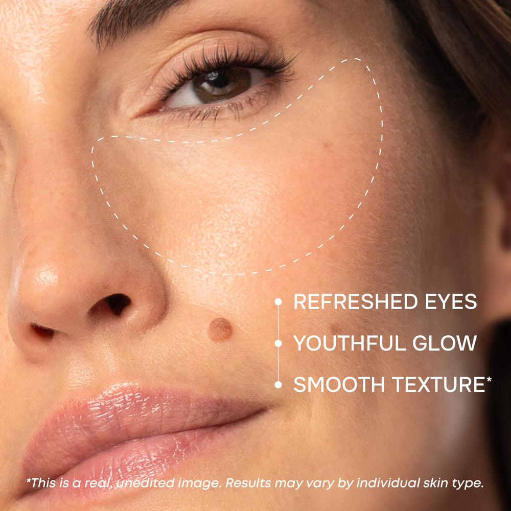 Patch SimplyVital yeux anti-poches éclaircit légèrement les cernes et unifie le teint