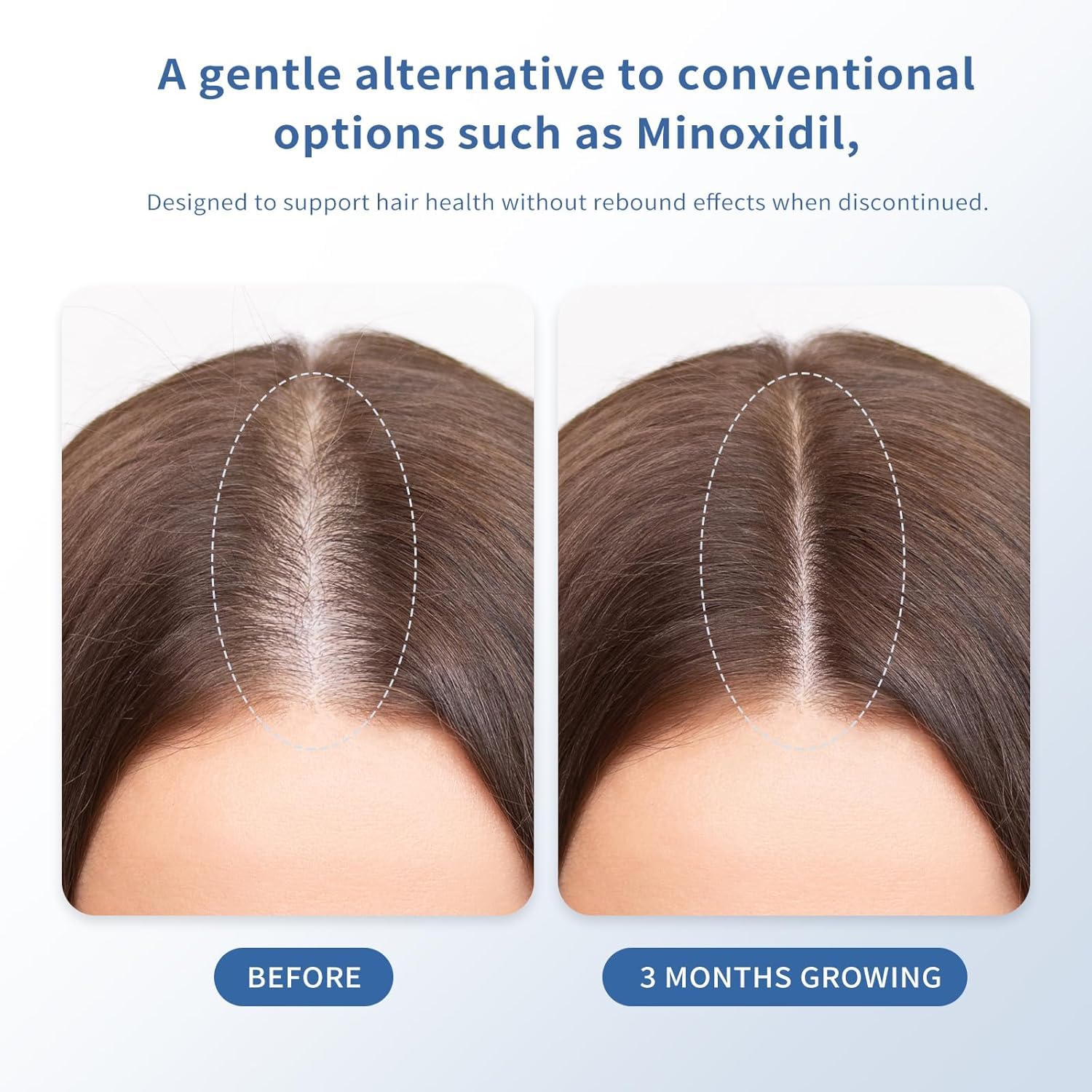 Singrace serum massage-cheveux conseil: conseils massage favorisent absorption.