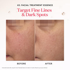 Essence traitement visage SK-II révèle l’éclat naturel et améliore la texture.