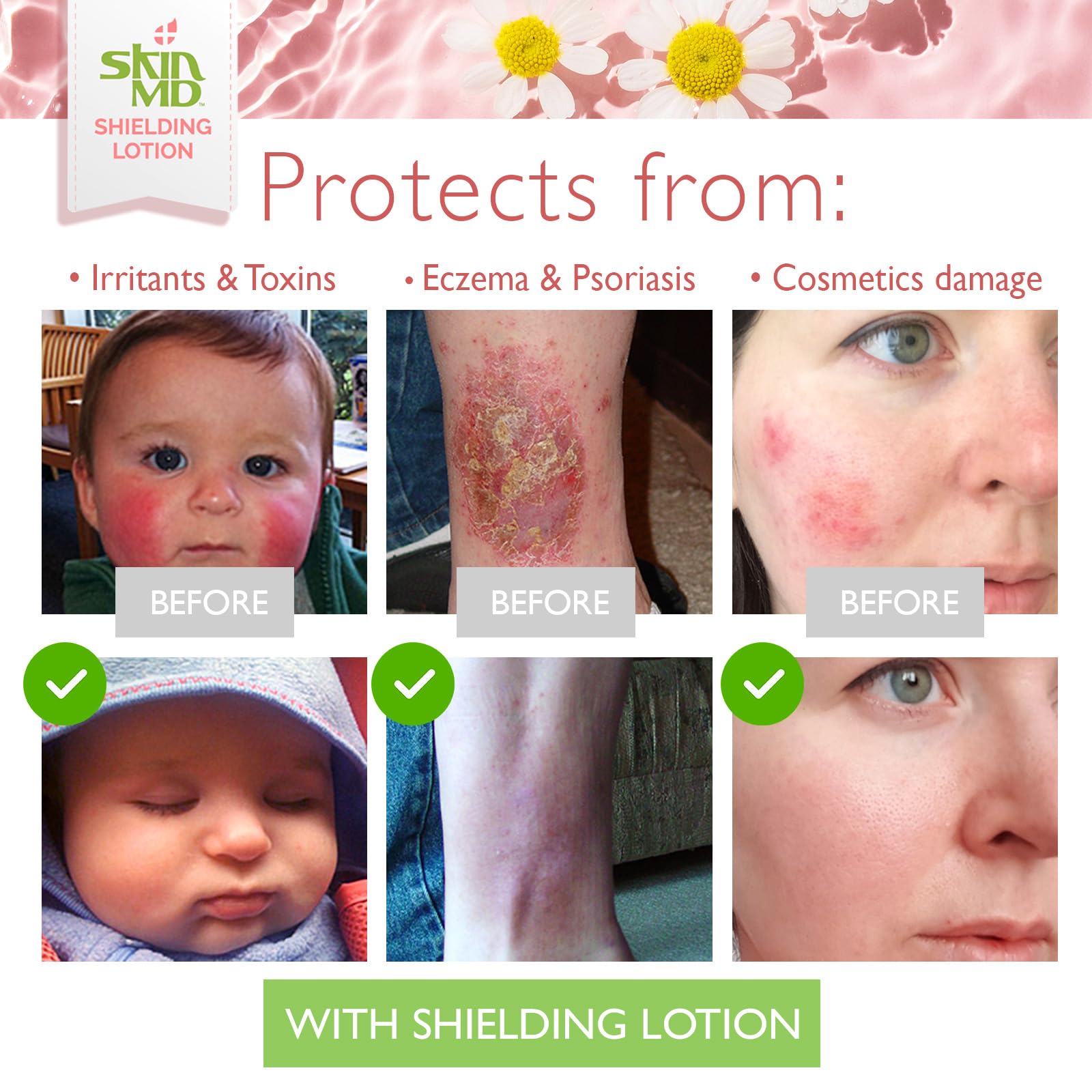 Sans parfum et sans colorant, Skin MD Shielding Lotion convient aux peaux sensibles