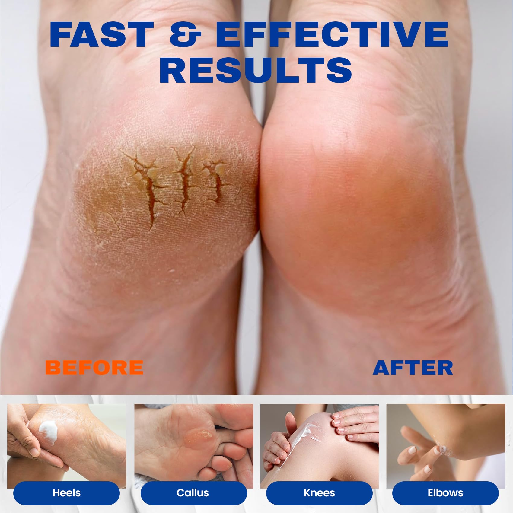 Application sur pieds et talons secs pour une douceur durable.